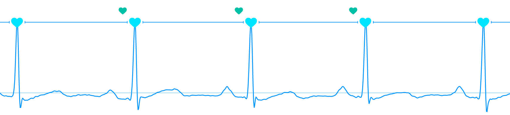 HRV